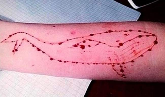 Blue Whale Challenge: SC junks plea seeking ban, asks states to run awareness campaigns