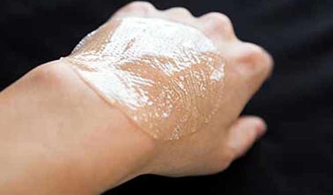 Indian scientists develop wound healing ointment
