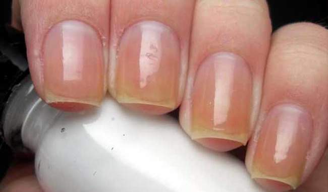 If you want long, beautiful and strong nails then follow these steps