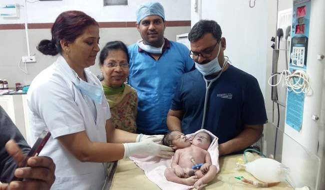 two-headed-baby-born-in-vidisha-madhya-pradesh-newborn-and-obstetric-both-healthy