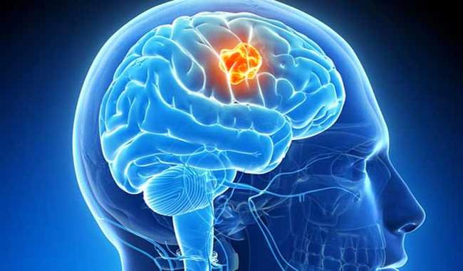 know-about-the-symptoms-of-brain-tumor-in-hindi