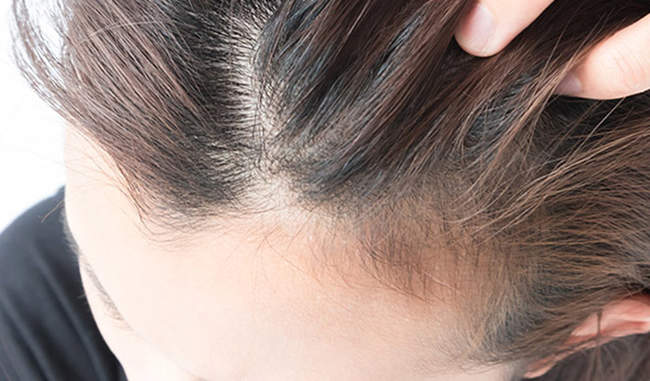 home-remedy-of-itchy-scalp-in-hindi