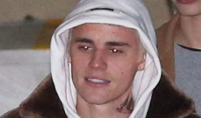 justin-bieber-a-victim-of-this-incurable-disease