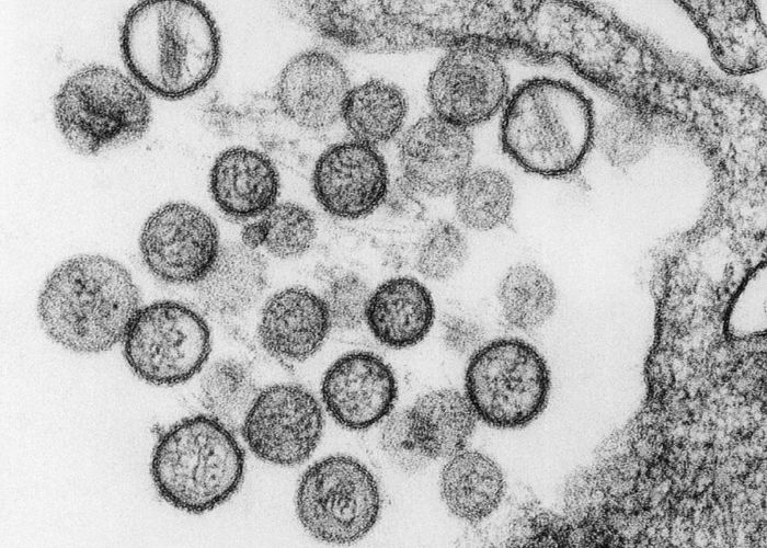 कोरोना के बाद अब हंता वायरस ने लिया विकराल रूप, जानें क्या है और कैसे फैलता है