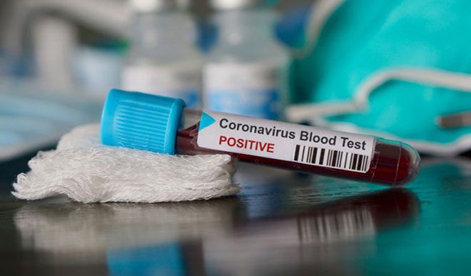 coronavirus