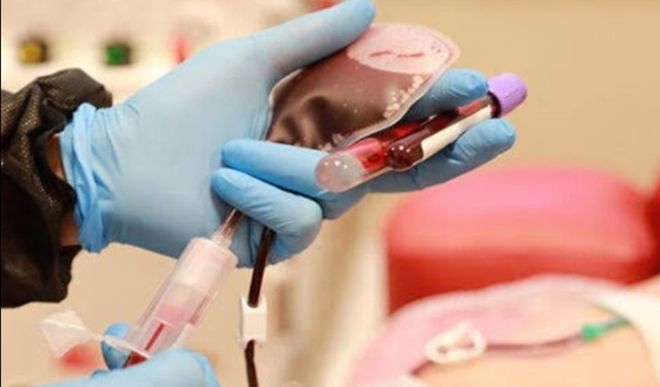 प्लाज्मा थेरेपी प्लाज्मा थेरेपी