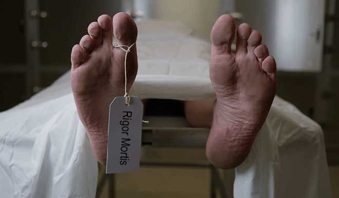 rigor mortis rigor mortis