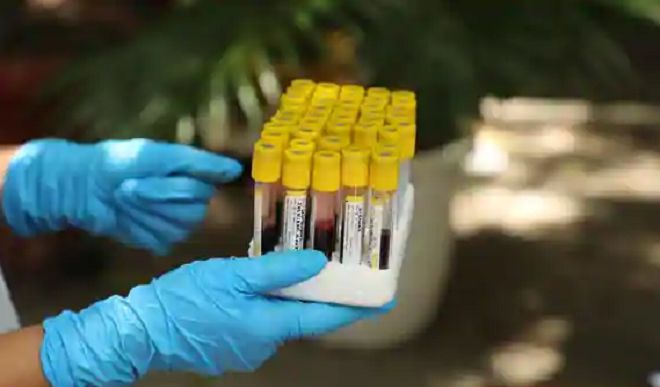 पुणे में 51.5 फीसदी नमूनों में कोरोना से लड़ने के लिए एंटीबॉडी मौजूद: सीरो सर्वेक्षण