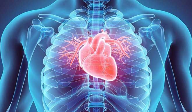 heart blockage heart blockage