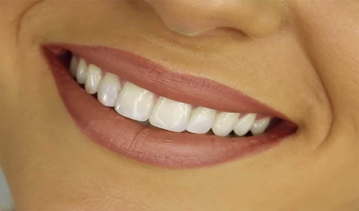 दांतों को चमकदार बनाए रखने के लिए अपनाएं भाग्यश्री द्वारा बताया गया यह नुस्खा
