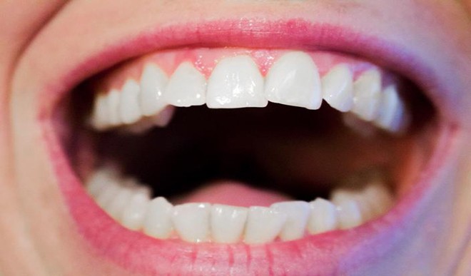 teeth care