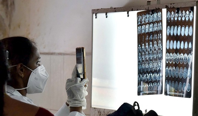 मध्य प्रदेश की राजधानी भोपाल में ब्लैक फंगस रोग से बचाव के लिए एडवाइजरी जारी