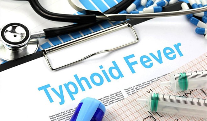 typhoid fever typhoid fever