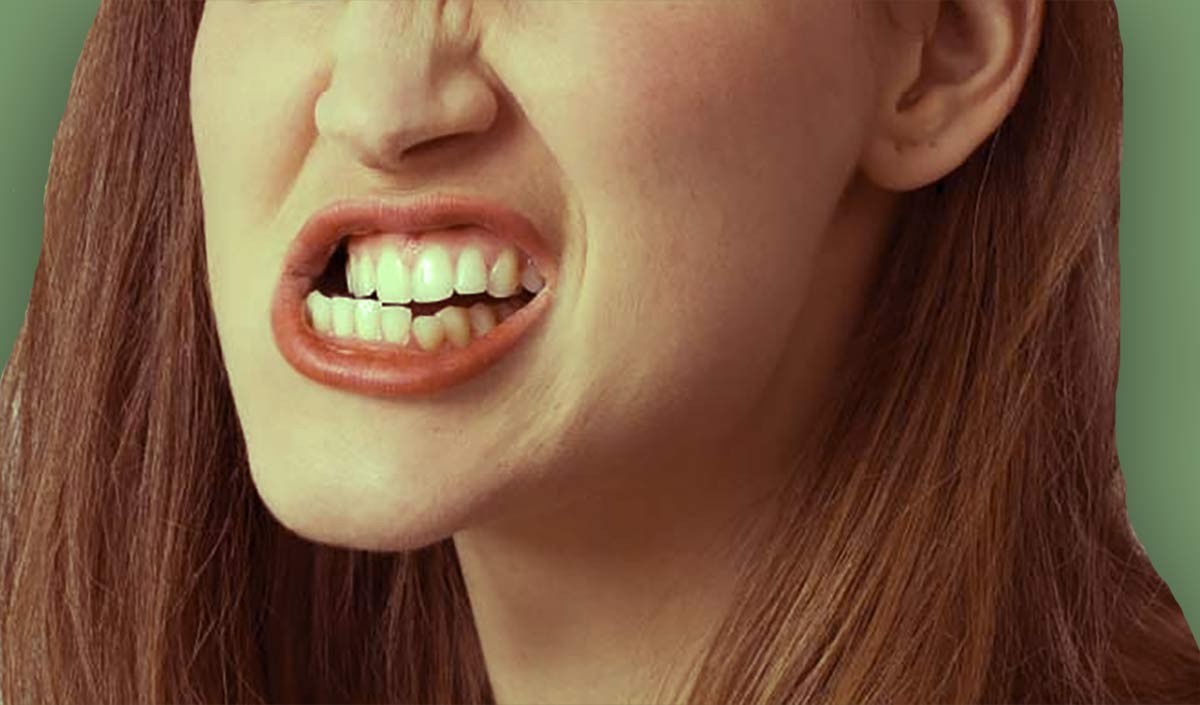 bruxism