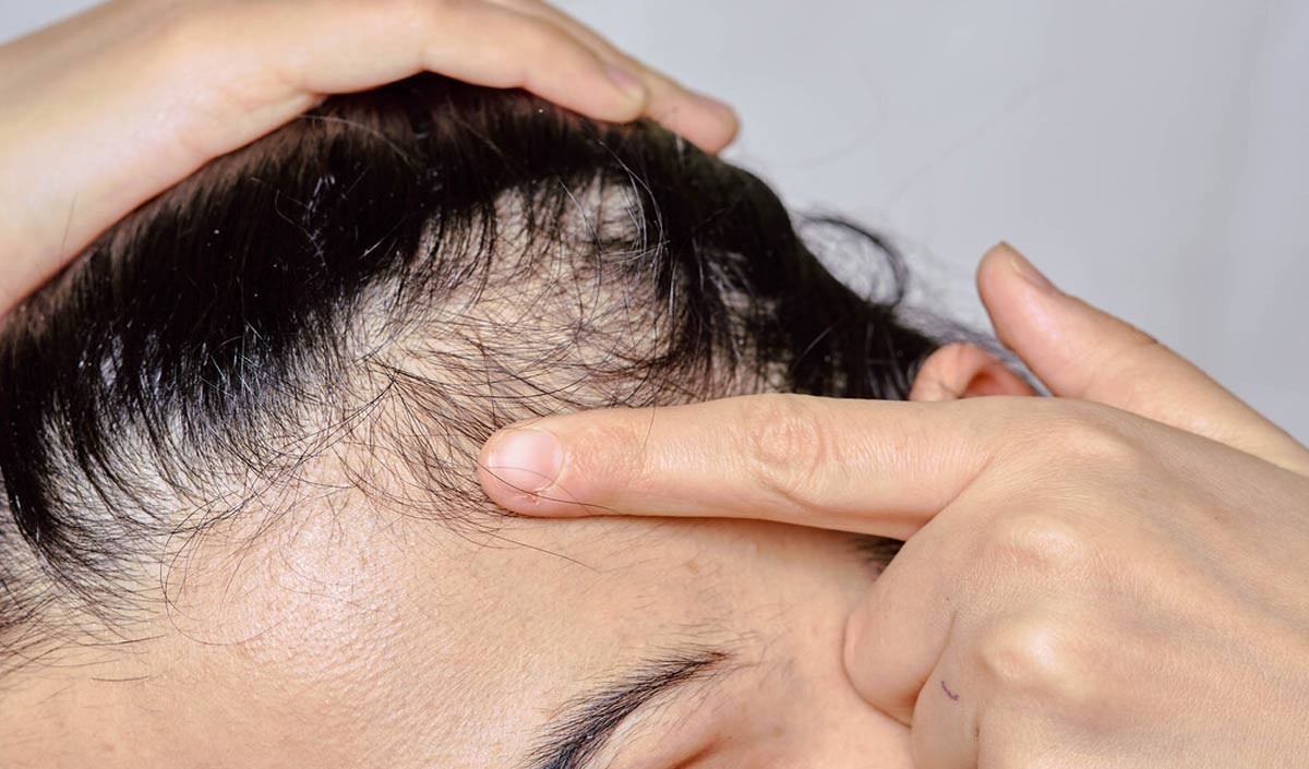स्कैल्प की खुजली से ना हों परेशान, बस अपनाएं ये उपाय - know the home  remedies for itchy scalp in hindi