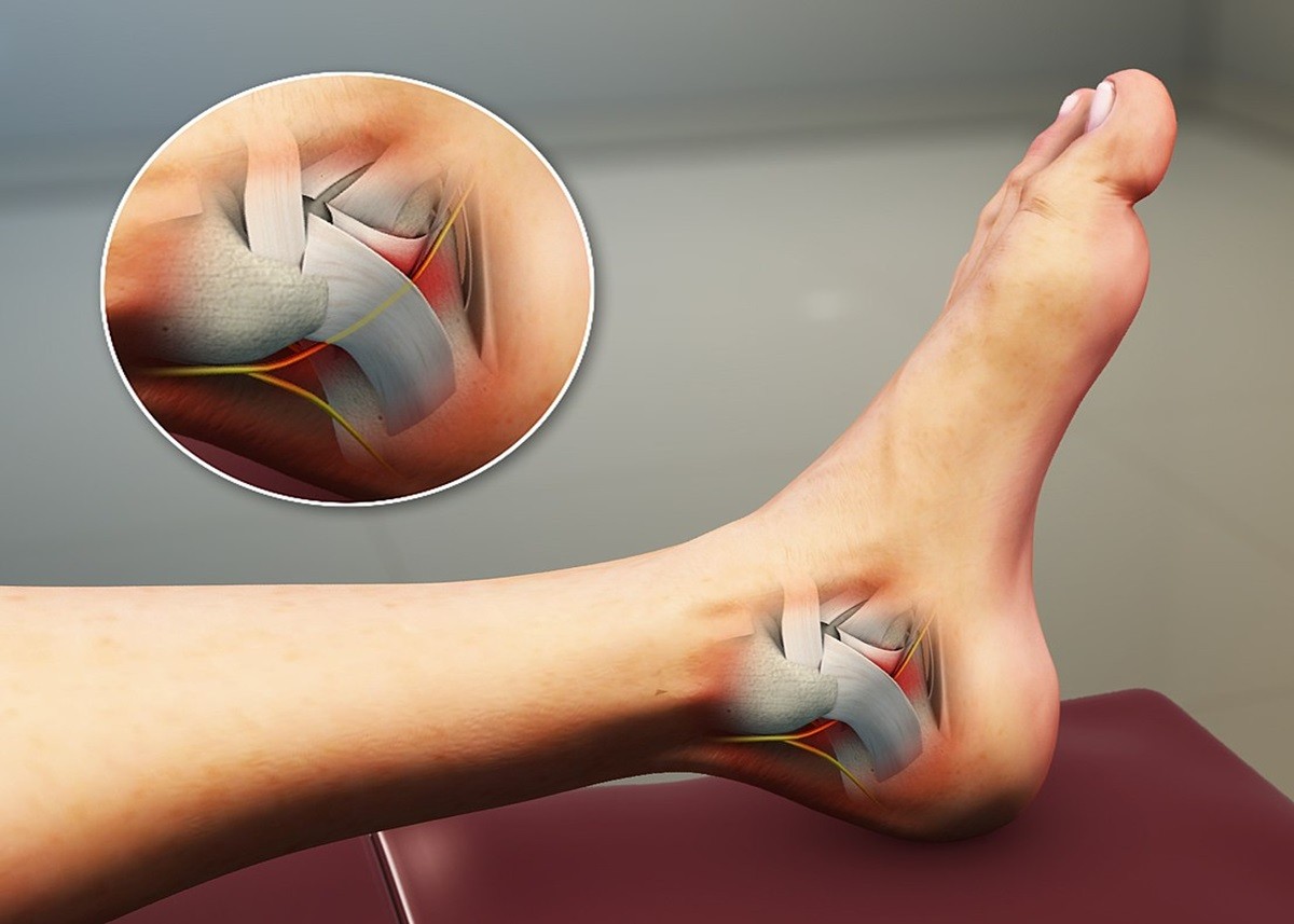 Heel Pain: ठंड में एड़ियों के दर्द से राहत पाने के लिए लगाएं ये देसी तेल, खींच लेगा सारा दर्द