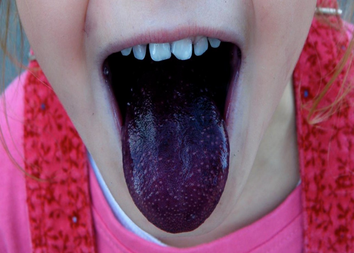 Tongue Color: जीभ देखकर पता लगा सकते हैं शरीर में है कौन सी बीमारी, यहां जानिए कैसे