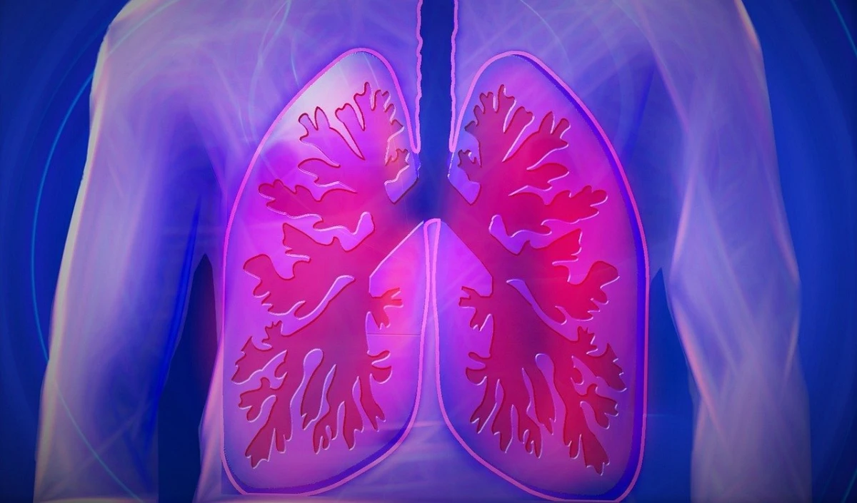 pulmonary fibrosis