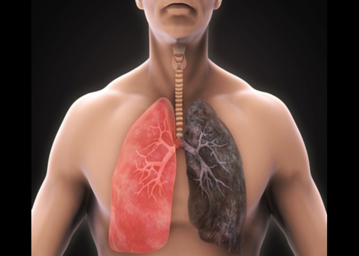 Lungs Health: इन चीजों के अधिक सेवन से फेफड़ों को होता है नुकसान, स्मोकिंग से भी ज्यादा है खतरनाक