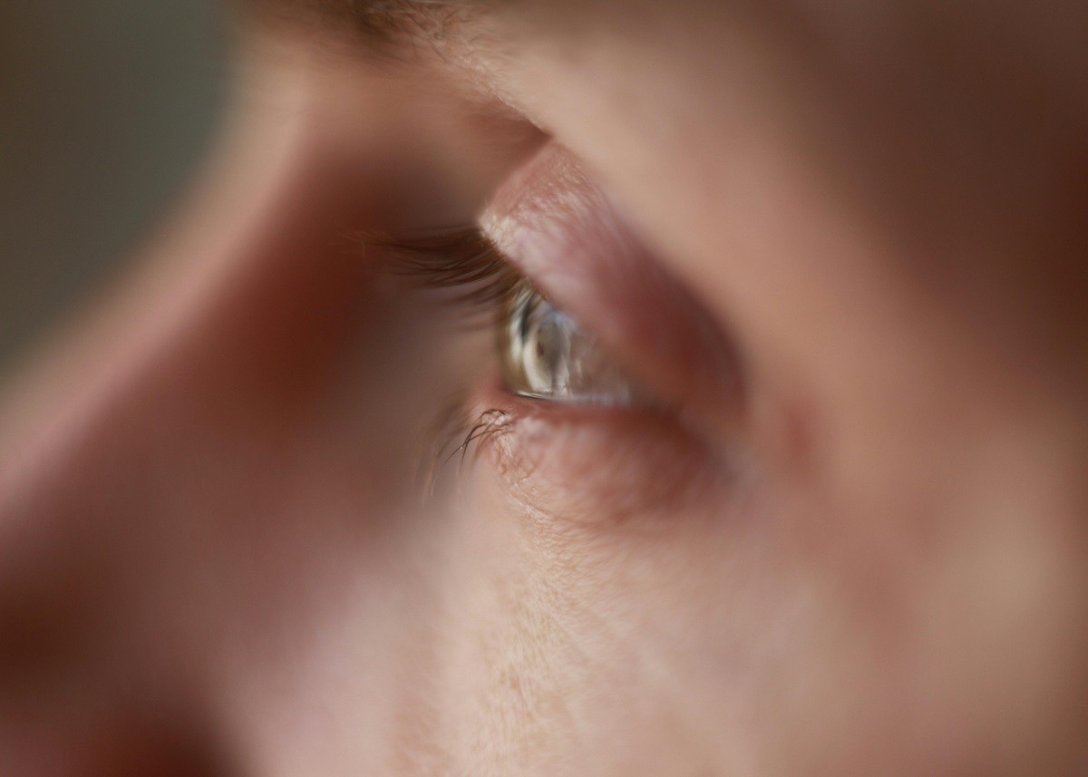 Summer Conjunctivitis: गर्मियों में आंख से जुड़ी बीमारियों का बढ़ जाता है खतरा, समर कंजंक्टिवाइटिस से ऐसे करें बचाव