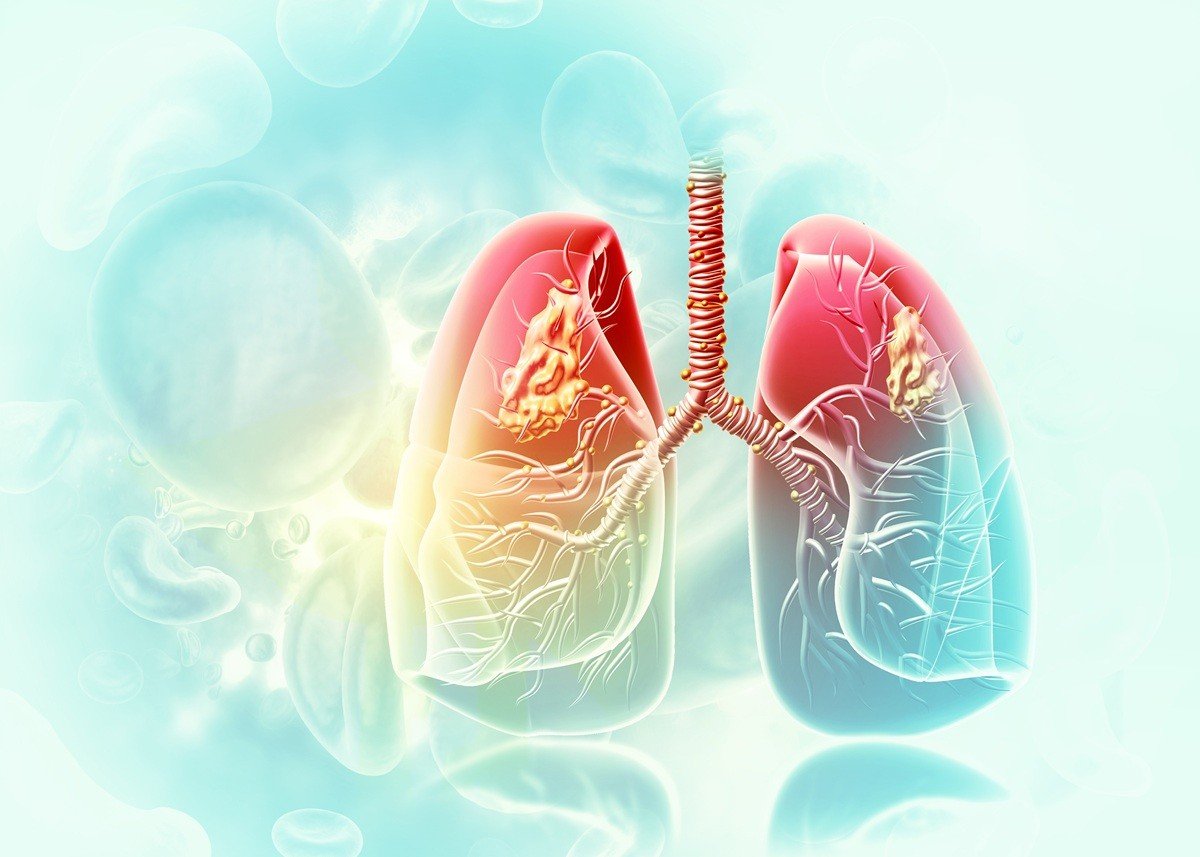How To Clean Lungs: प्रदूषण के दौर में फेफड़ों को रखें सुरक्षित, अपनाएं ये आसान जीवनशैली बदलाव