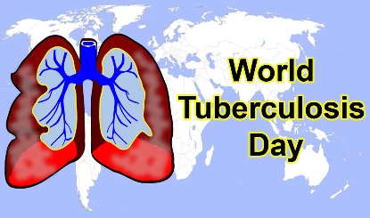 World Tuberculosis Day 2025: सरकार के छोटे-छोटे कदम टीबी मुक्त भारत की दिशा में मील का पत्थर साबित होंगे