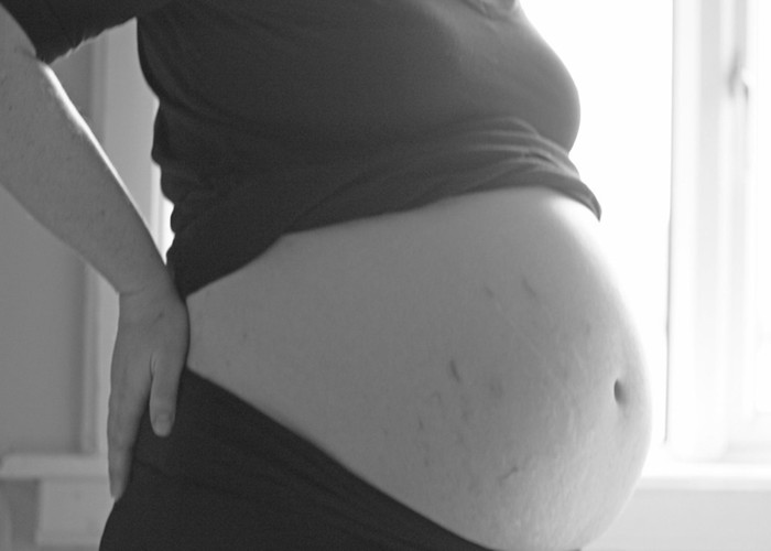 Pregnancy में स्‍ट्रेच मार्क की छुट्टी कर देंगे ये घरेलू नुस्खा, आप भी जरूर करें ट्राई