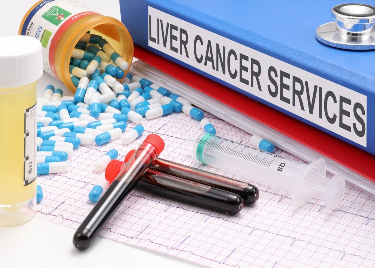 Liver Tumor Symptoms: जानलेवा साबित हो सकता है लिवर ट्यूमर, जानिए लक्षण और बचाव के तरीके