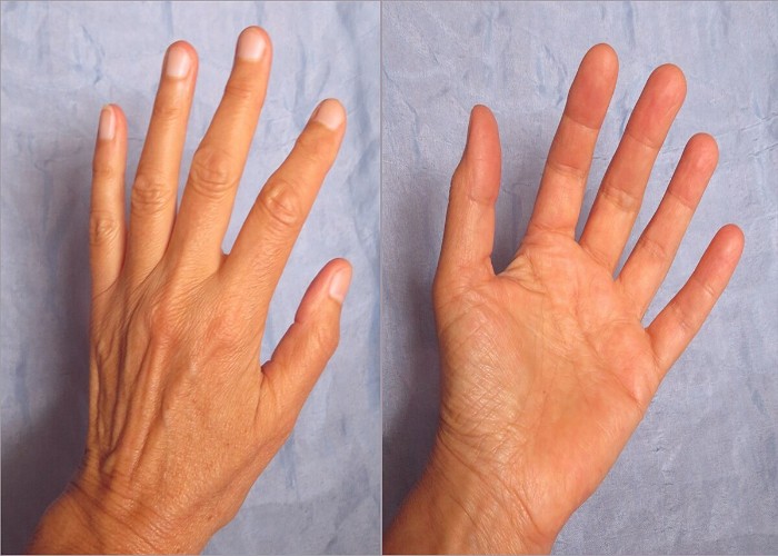 Lucky Signs on Palm: चेक करें अपनी हथेली, ये 3 Lucky Palm Signs बताते हैं कितने भाग्यशाली हैं आप