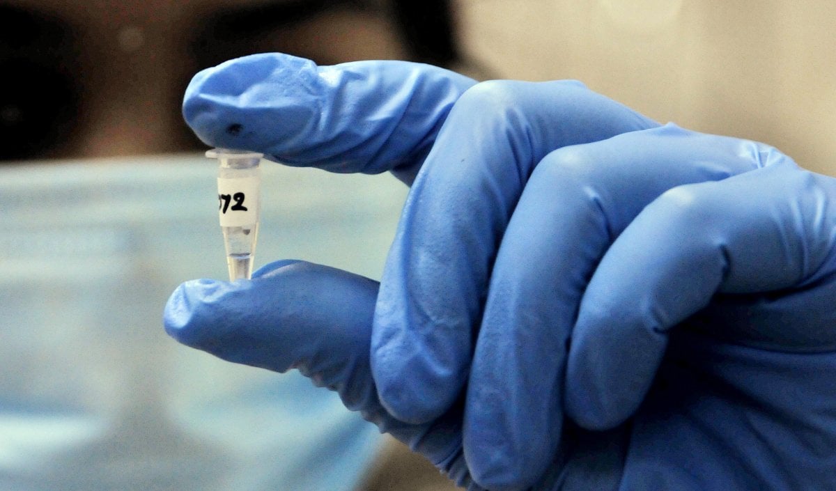 Russia Mysterious Virus | हाथ से छूटी