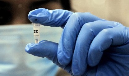 Russia Mysterious Virus | हाथ से छूटी 