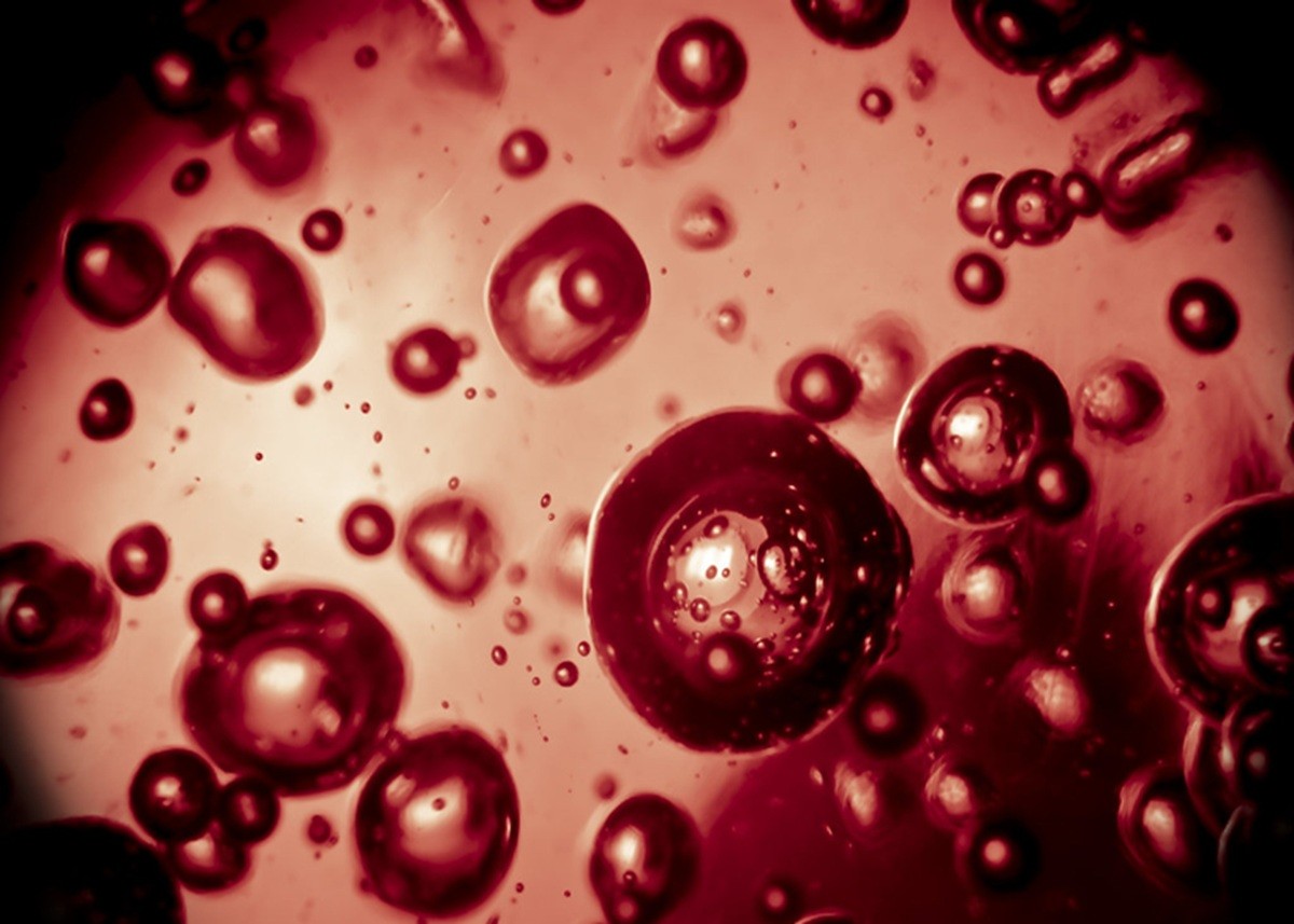 Iron Deficiency: महिलाओं की ये आम गलतियां खामोशी से बढ़ रही हैं एनीमिया का खतरा, हो जाइए सावधान