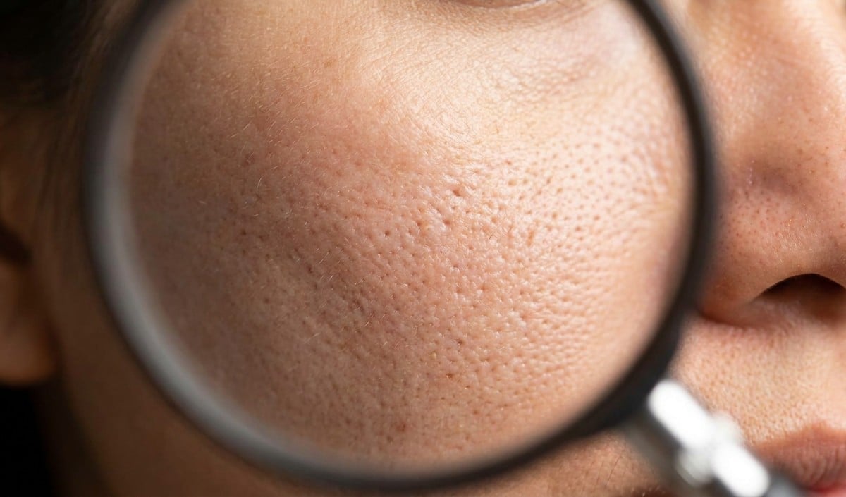 Open Pores Open Pores