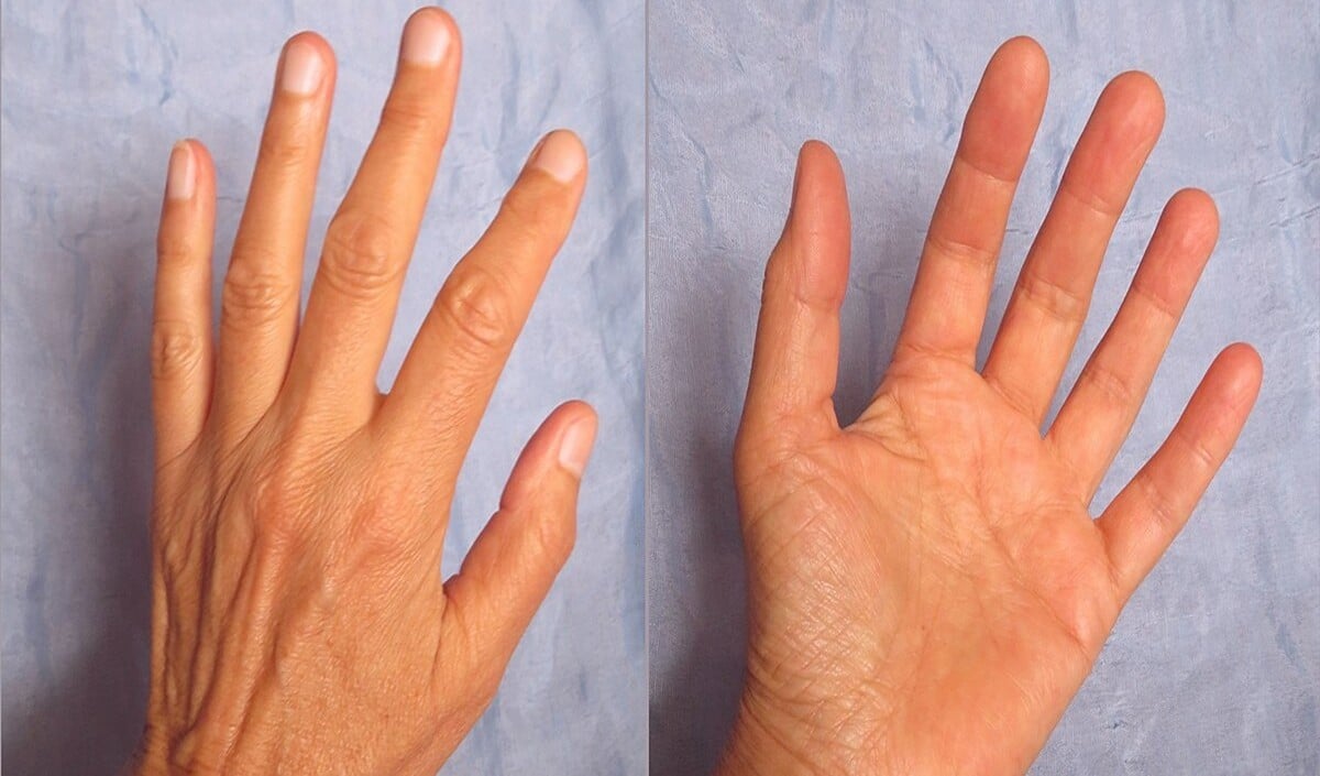 Nail Palmistry: आपके नाखून दे रहे हैं Bad Luck का संकेत? जानें ग्रहों का ये बड़ा इशारा​