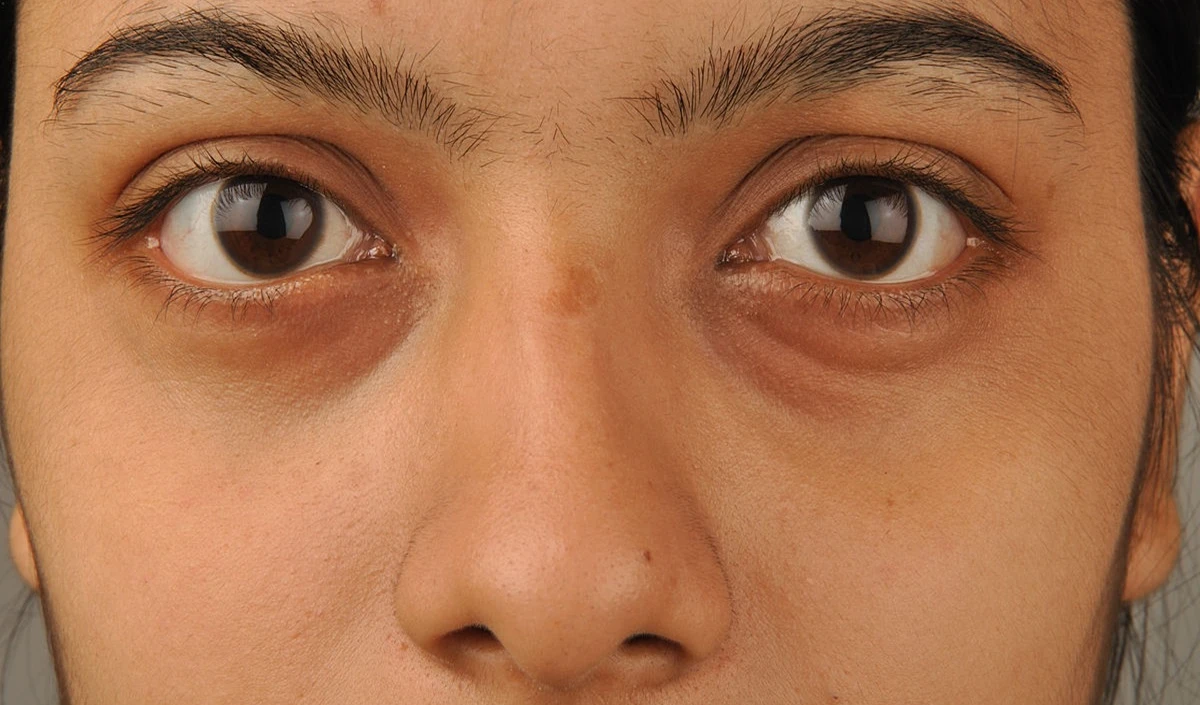 Under Eye Patches Under Eye Patches