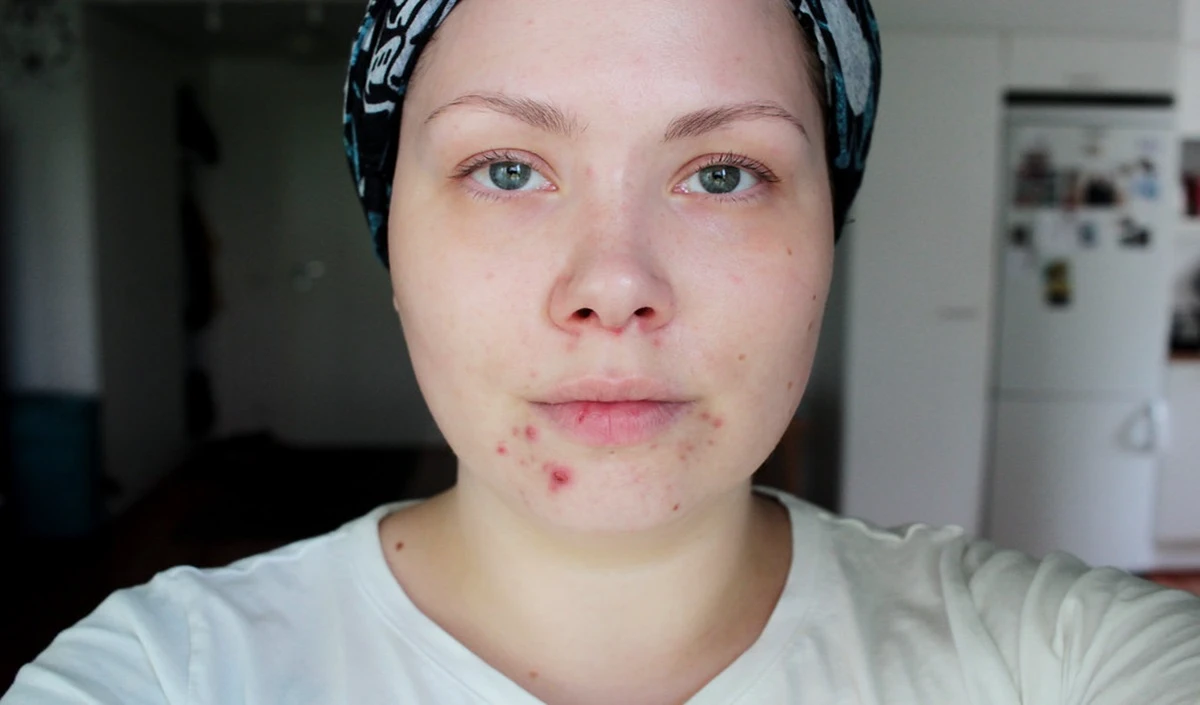 Beauty Tips Beauty Tips
