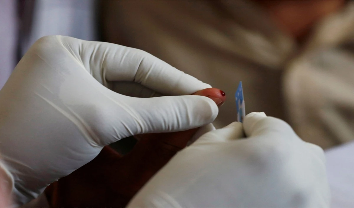 Delhi H1N1 Surge: राजधानी में स्वाइन फ्लू के 1,349 मामले, Delhi Hospitals ने कसी कमर