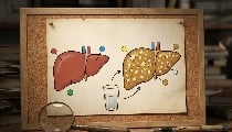 Fatty Liver रिवर्स करने के लिए अपनाएं ये 4 Home Remedies, नानी मां के नुस्खों से Liver Health होगी बेहतर