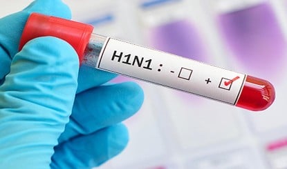 Delhi-NCR में H1N1 का कहर: Oxygen Level गिरने से मरीजों की बढ़ी मुसीबत, स्वाइन फ्लू के 6 गुना ज्यादा Cases